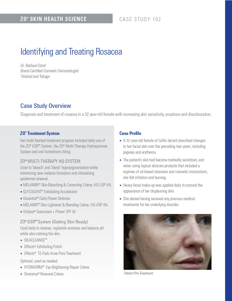 ZO Skin Health case study Identifying and Treating Rosacea Image RX