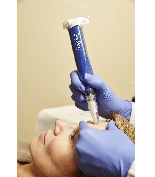 skinpen